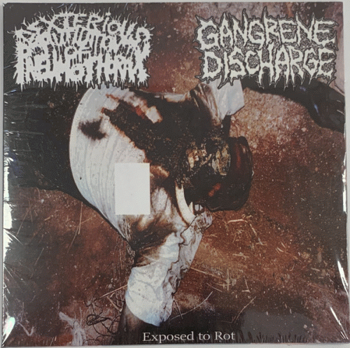 Gangrene Discharge : Exposed to Rot
